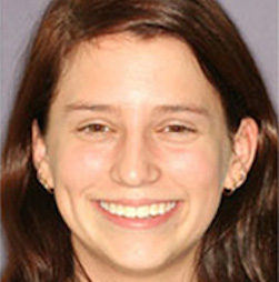 Orthodontic treatment after