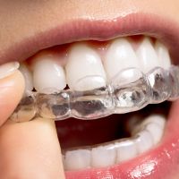 Invisalign Invisalign