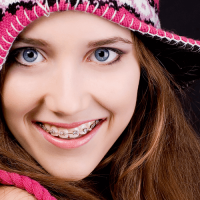 Non-extraction treatment Non-extraction treatment